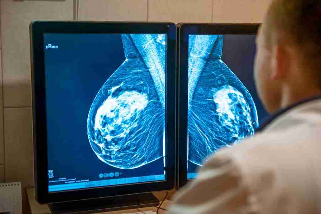 Doctor looking at a mammogram - this procedure is important in the risks of breast cancer