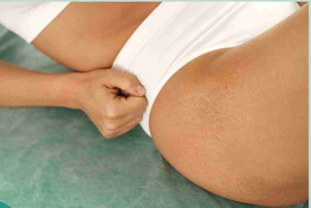 Menopause hip pain - woman lying on the bed pressing a hand against her R hip