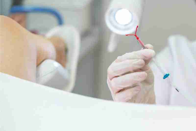 doctor about to fit an IUD - article explores why women hate Copper or Mirena IUD 